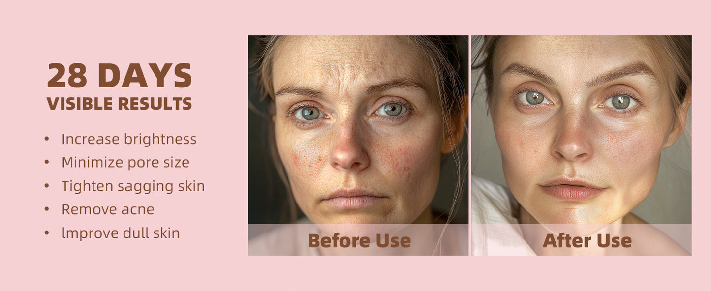 Levensa - LED Beauty Maske